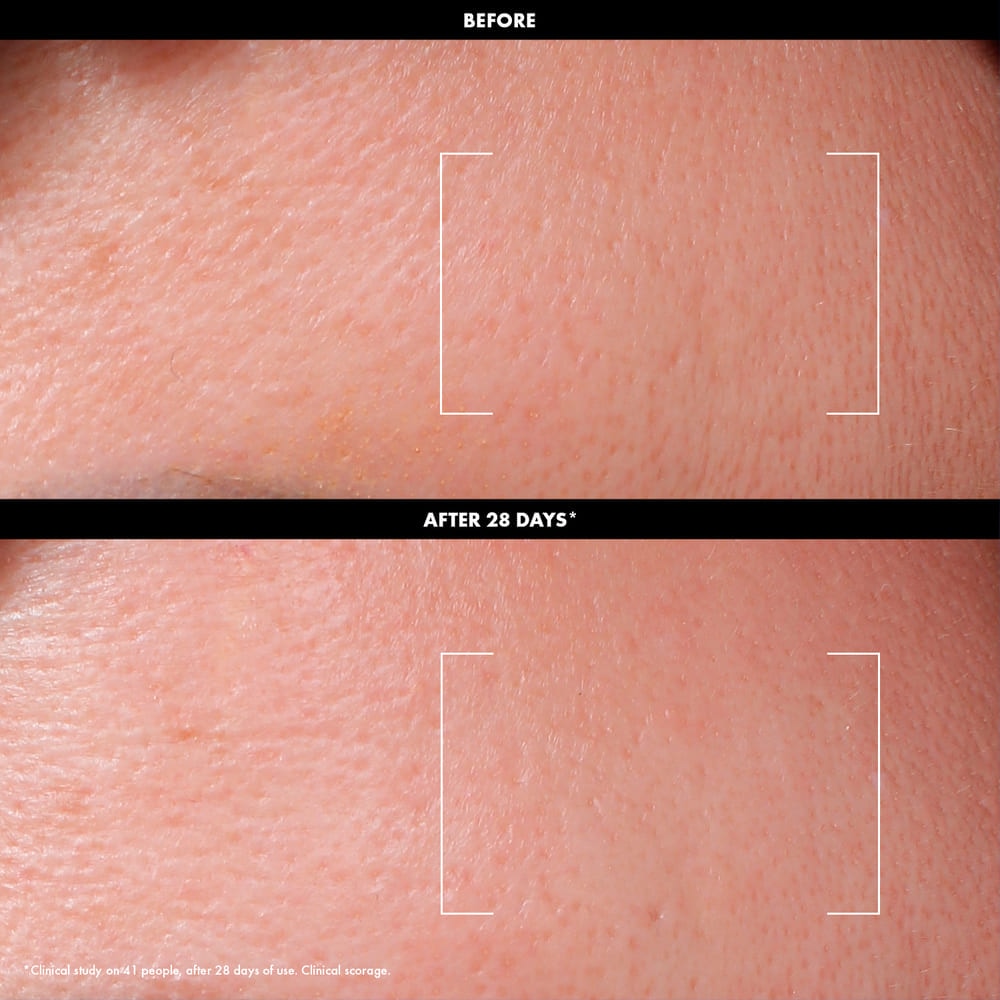 DAILY RESURFACING TONER (T&Oacute;NICO EXFOLIANTE CON 3% AHA + 2% VITAMINA C)